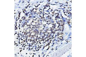 Immunohistochemistry of paraffin-embedded human lymph node using TP73 Rabbit pAb (ABIN6133470, ABIN6149430, ABIN6149431 and ABIN6213831) at dilution of 1:100 (40x lens). (Tumor Protein p73 antibody  (AA 1-100))