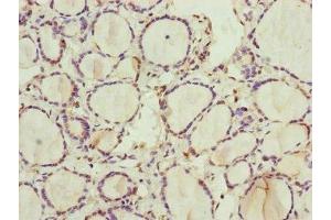 Immunohistochemistry of paraffin-embedded human thyroid tissue using ABIN7168238 at dilution of 1:100 (RNF11 antibody  (AA 1-154))