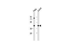 All lanes : Anti-PR38A Antibody (C-term) at 1:1000 dilution Lane 1: Hela whole cell lysate Lane 2: Jurkat whole cell lysate Lysates/proteins at 20 μg per lane.