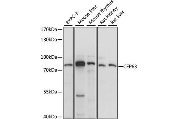 CEP63 antibody  (AA 1-300)