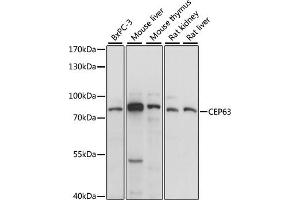 Western blot analysis of extracts of various cell lines, using CEP63 antibody (ABIN7266278) at 1:1000 dilution. (CEP63 antibody  (AA 1-300))