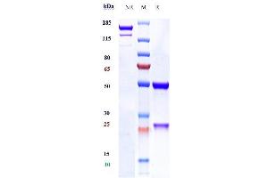 Anti-PAR2 Reference Antibody (PAR650097) on SDS-PAGE under reducing (R) condition.