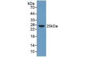 Western blot analysis of Human Serum. (CRP antibody  (AA 17-224))