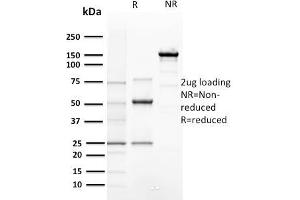 SDS-PAGE Analysis of Purified Cyclin E1 Mouse Recombinant Monoclonal Antibody ABIN6383795. (Cyclin E1 antibody  (AA 10-176))