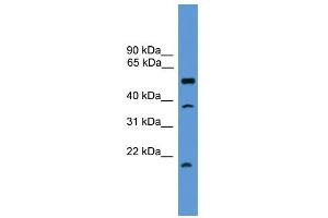 WB Suggested Anti-SPINT2 Antibody Titration: 0. (SPINT2 antibody  (Middle Region))