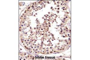 Immunohistochemistry (Formalin/PFA-fixed paraffin-embedded sections) of human testis tissue with LOC728137 polyclonal antibody  followed by peroxidase conjugation of the secondary antibody and DAB staining. (TSPY3 antibody  (AA 274-303))