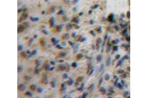 #VALUE! (AFT1 antibody  (AA 3-213))