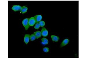 IF analysis of Cytochrome C using anti-Cytochrome C antibody (ABIN5693008). (Cytochrome C antibody  (AA 2-105))