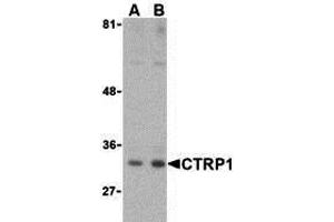 Western Blotting (WB) image for anti-C1q and Tumor Necrosis Factor Related Protein 1 (C1QTNF1) (Middle Region) antibody (ABIN1030910) (C1QTNF1 antibody  (Middle Region))