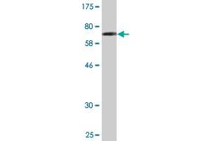 Western Blot detection against Immunogen (66 KDa) . (TARBP2 antibody  (AA 1-366))