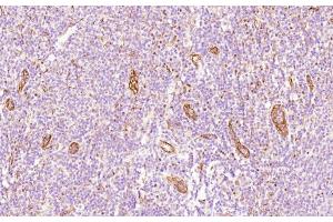 Immunohistochemical analysis of paraffin-embedded Human tonsil section using Pink1 (ABIN658983 and ABIN2838032). (CD34 antibody  (AA 185-214))