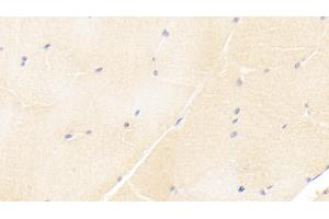 Detection of ISLR in Human Skeletal muscle Tissue using Monoclonal Antibody to Immunoglobulin Superfamily Containing Leucine Rich Repeat Protein (ISLR) (ISLR antibody  (AA 19-428))