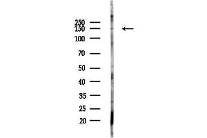 Western blot analysis of lysates from Rat lung, using NKCC2 Antibody at 1/1000 dilution.