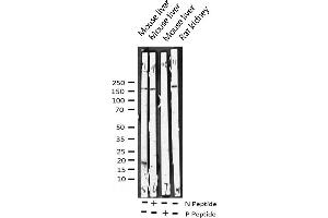 Western blot analysis of Phospho-HER4 (Tyr1284) expression in various lysates (ERBB4 antibody  (pTyr1284))