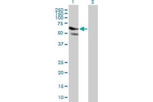 Western Blot analysis of GPATCH2 expression in transfected 293T cell line by GPATCH2 MaxPab polyclonal antibody. (GPATCH2 antibody  (AA 1-376))