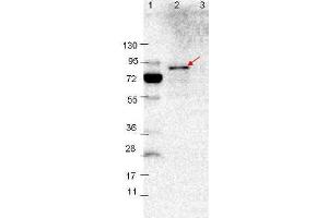 Western blot showing detection of 0. (VlsE antibody)