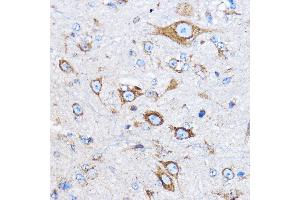 Immunohistochemistry (IHC) image for anti-Cathepsin B (CTSB) (AA 1-339) antibody (ABIN3021176)