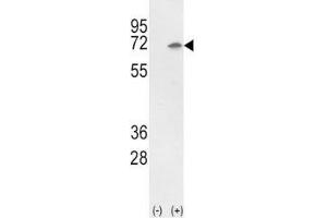 Western blot analysis of Ku70 antibody and 293 cell lysate (2 ug/lane) either nontransfected (Lane 1) or transiently transfected with the Ku70 gene (2). (XRCC6 antibody  (AA 432-461))
