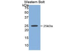 Western blot analysis of the recombinant protein. (SPRY2 antibody  (AA 116-304))