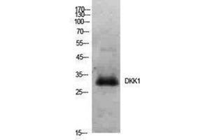 Western Blotting (WB) image for anti-Dickkopf Homolog 1 (DKK1) (Internal Region) antibody (ABIN3178908) (DKK1 antibody  (Internal Region))
