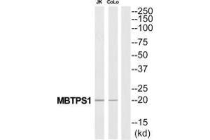 Western blot analysis of extracts from Jurkat/COLO205 cells, using MBTPS1 antibody. (MBTPS1 antibody  (C-Term))