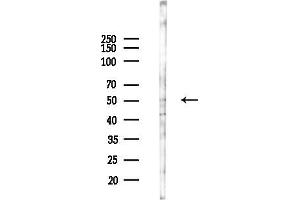 anti-Tripartite Motif Containing 44 (TRIM44) (Internal Region) antibody