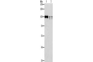 Gel: 8 % SDS-PAGE, Lysate: 40 μg, Lane 1-2: K562 cells, Jurkat cells, Primary antibody: ABIN7128244(ADAMTSL2 Antibody) at dilution 1/350, Secondary antibody: Goat anti rabbit IgG at 1/8000 dilution, Exposure time: 5 minutes (ADAMTSL2 antibody)