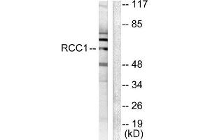 Western Blotting (WB) image for anti-Regulator of Chromosome Condensation (RCC1) and BTB (POZ) Domain Containing Protein 1 (RCBTB1) (Internal Region) antibody (ABIN1848759) (RCBTB1 antibody  (Internal Region))