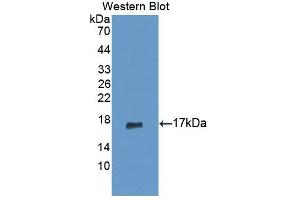 Detection of Recombinant PIP, Human using Polyclonal Antibody to Prolactin Induced Protein (PIP) (PIP antibody  (AA 41-139))
