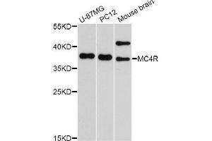 Western blot analysis of extracts of various cell lines, using MC4R Antibody (ABIN5998196) at 1/1000 dilution. (MC4R antibody)
