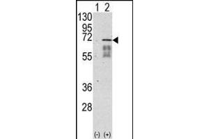Western blot analysis of ACVR1 (arrow) using rabbit polyclonal ACVR1 Antibody (Center ) (ABIN391154 and ABIN2841264). (ACVR1 antibody  (AA 138-170))