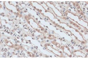 Immunohistochemistry of paraffin-embedded Mouse kidney using ZNF581 Polyclonal Antibody at dilution of 1:100 (40x lens). (ZNF581 antibody)