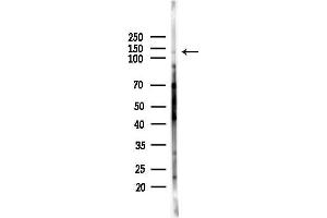 Western blot analysis of lysates from HepG2 cells(starvation,24h treatment), using Cacna2d1 Antibody at 1/1000 dilution.