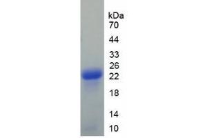 SDS-PAGE analysis of Human Afamin Protein.