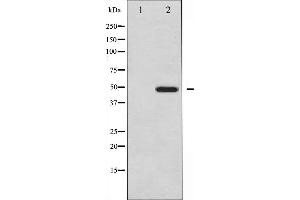 Western blot analysis of Vitamin D Receptor expression in Jurkat whole cell lysates,The lane on the left is treated with the antigen-specific peptide. (Vitamin D Receptor antibody  (Internal Region))