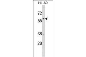 Western blot analysis in HL-60 cell line lysates (35ug/lane). (TFAP2D antibody  (C-Term))