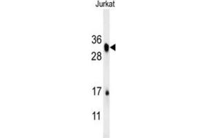 Western Blotting (WB) image for anti-R-Spondin 4 (RSPO4) antibody (ABIN3002419) (R-Spondin 4 antibody)