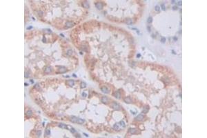 Figure. (TLN2 antibody  (AA 2240-2492))