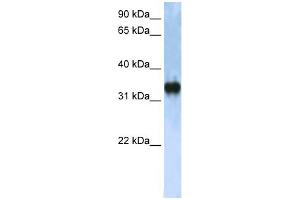 WB Suggested Anti-ZCCHC17 Antibody Titration:  0. (ZCCHC17 antibody  (C-Term))