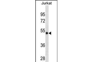 ARSA Antibody (C-term) (ABIN1536617 and ABIN2843873) western blot analysis in Jurkat cell line lysates (35 μg/lane). (Arylsulfatase A antibody  (C-Term))