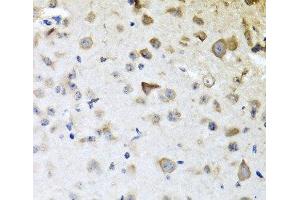 Immunohistochemistry of paraffin-embedded Mouse brain using CPA6 Polyclonal Antibody at dilution of 1:100 (40x lens). (CPA6 antibody)