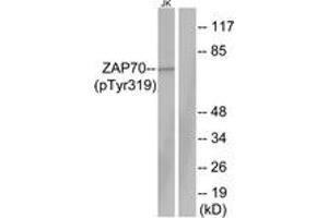 Western blot analysis of extracts from Jurkat cells, using ZAP-70 (Phospho-Tyr319) Antibody. (ZAP70 antibody  (pTyr319))
