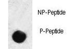 Dot blot analysis of phospho-SMAD3 antibody.