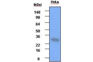Western blot analysis: Cell lysates of HeLa(each 30ug) were resolved by SDS-PAGE, transferred to PVDF membrane and probed with anti-human Hsp27 (1:1000).