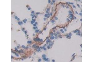 Used in DAB staining on fromalin fixed paraffin- embedded Kidney tissue (VIPR1 antibody  (AA 34-146))
