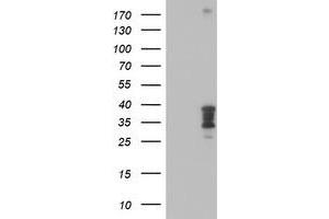 HEK293T cells were transfected with the pCMV6-ENTRY control (Left lane) or pCMV6-ENTRY HOXC11 (Right lane) cDNA for 48 hrs and lysed. (HOXC11 antibody  (AA 1-304))