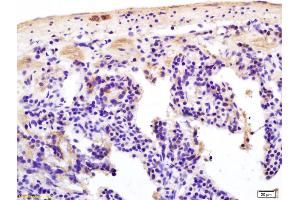 Formalin-fixed and paraffin embedded mouse intestine labeled with Anti-S100B Polyclonal Antibody, Unconjugated (ABIN676703) at 1:200 followed by conjugation to the secondary antibody and DAB staining. (S100B antibody  (AA 31-92))