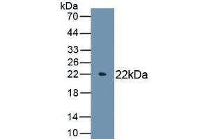 Detection of Recombinant IL6, Chicken using Polyclonal Antibody to Interleukin 6 (IL6) (IL-6 antibody  (AA 87-241))