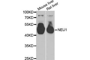 Western Blotting (WB) image for anti-Sialidase 1 (Lysosomal Sialidase) (NEU1) antibody (ABIN1980315) (NEU1 antibody)