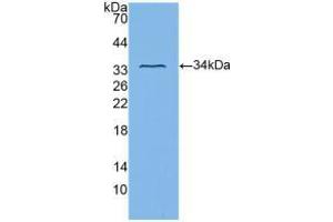 Western blot analysis of recombinant Human ITGb3. (Integrin beta 3 antibody  (AA 135-377))